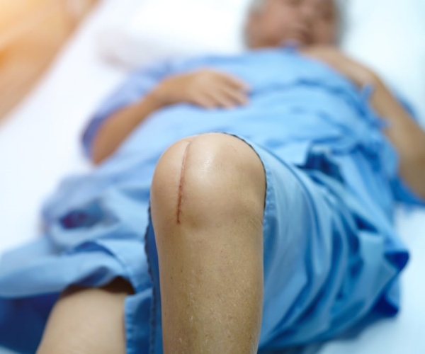 person having surgery on knee