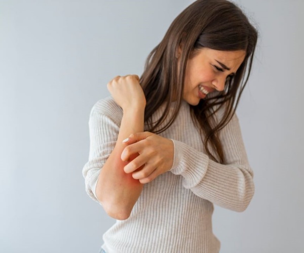 woman itching her arm due to eczema