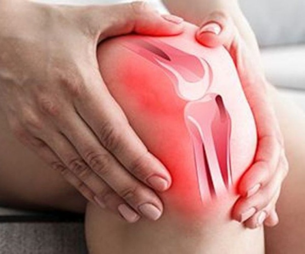 illustration of a knee with osteoarthritis 