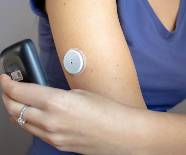 woman's arm with a continuous glucose monitor on it