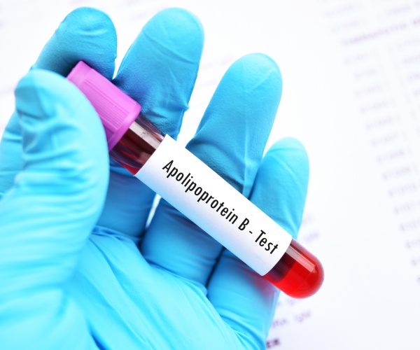 blood test with 'apolipoprotein b' label