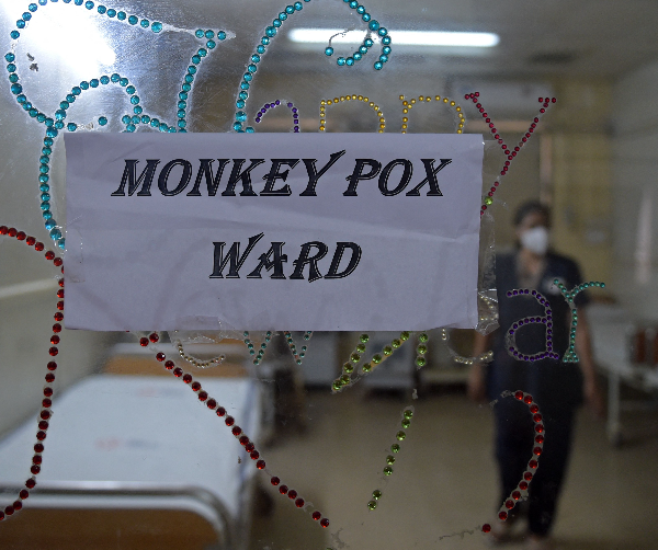 monkeypox ward