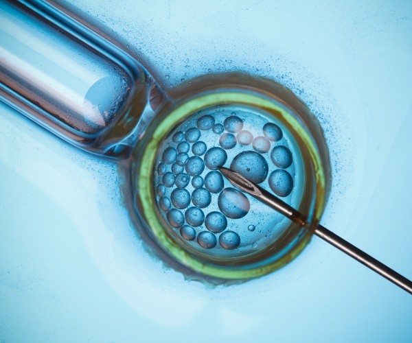 Did Ala. IVF Ruling Commodify Life, or Sanctify It? 