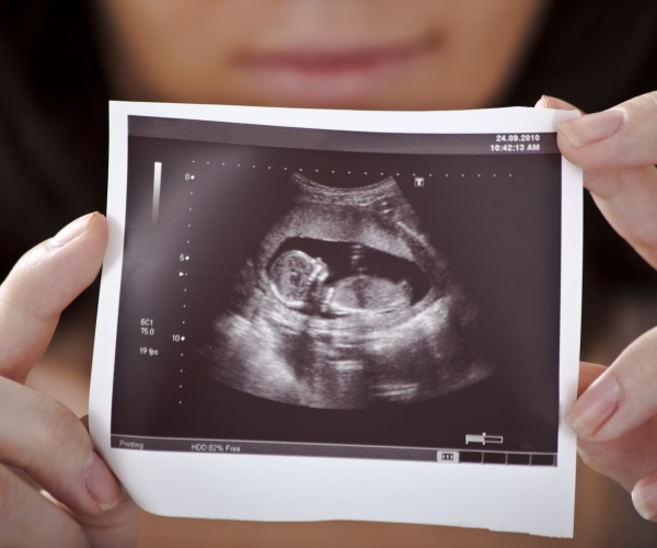 woman holding ultrasound picture of her baby