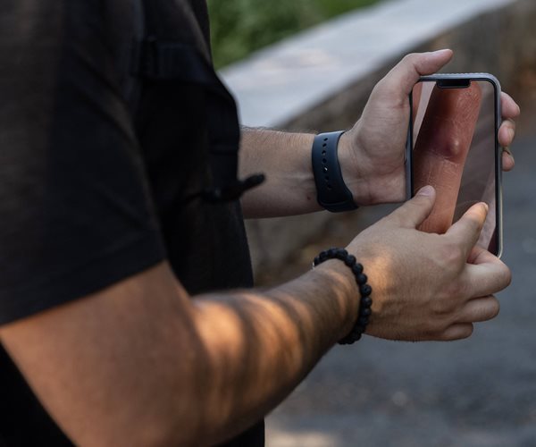 Man holding a phone showing a photo of a rash