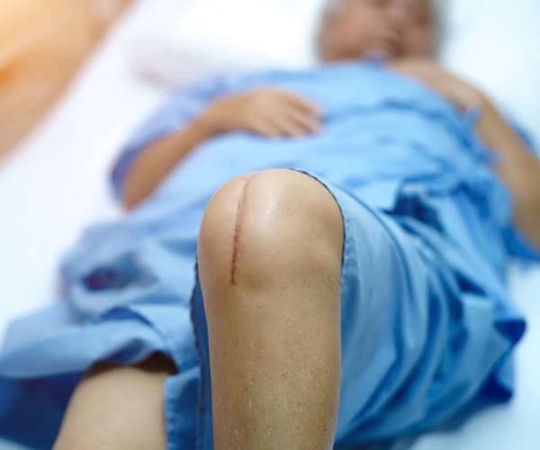 person in hospital bed with incision on knee