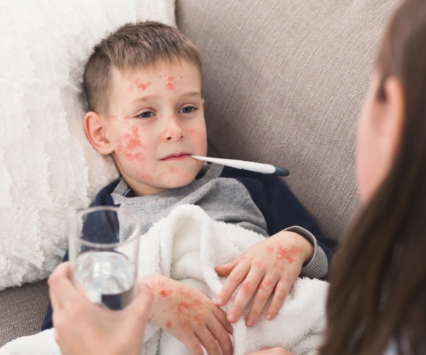 child with measles on couch, thermometer in mouth