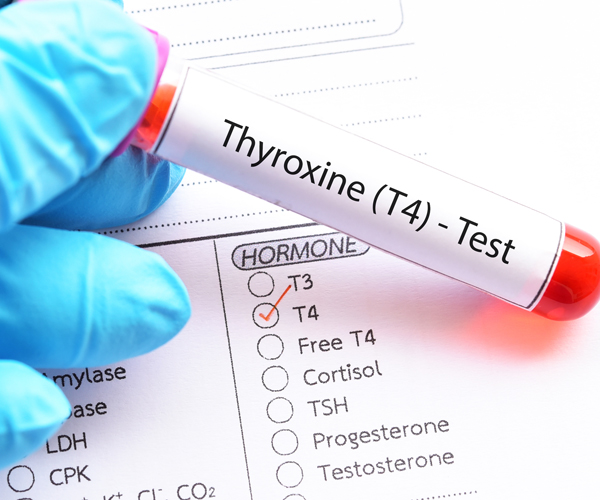 thyroid test