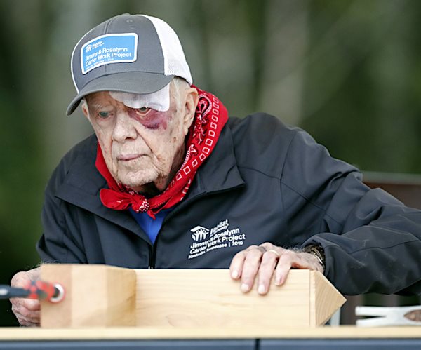 jimmy carter wears a cap and has a bruised face