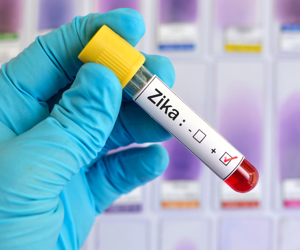 a blood test for the zika virus