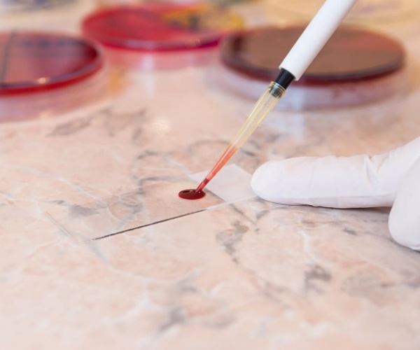 scientist testing blood on slide