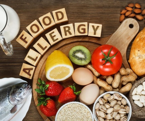 "Food Allergy" spelled out in blocks with many foods that cause allergic reactions