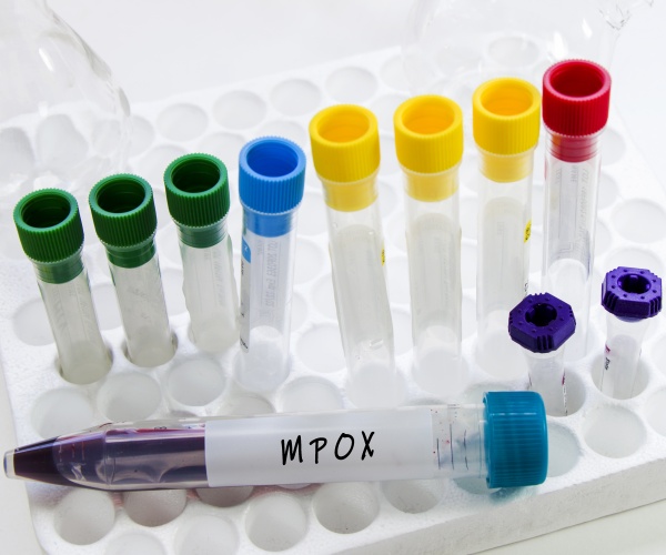 vials of mpox virus being studied by scientists