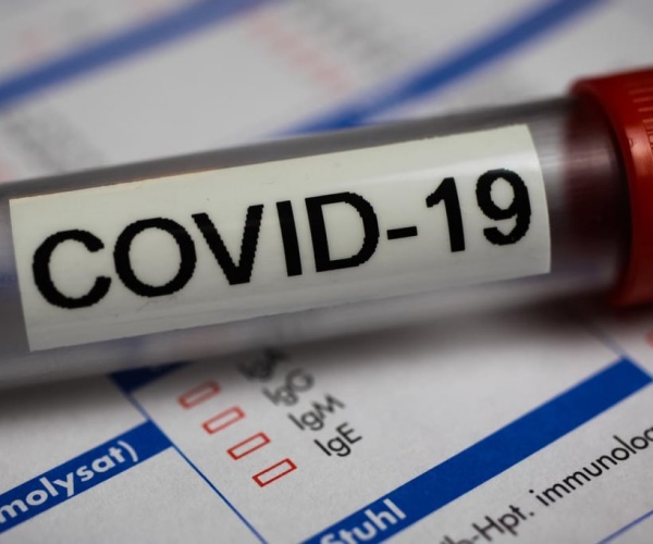 positive COVID blood test