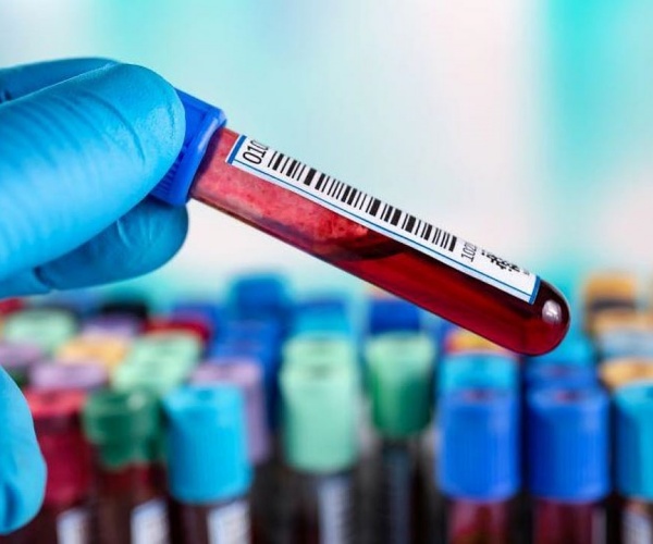 gloved hand holding a vial of blood, with other vials in lab behind it