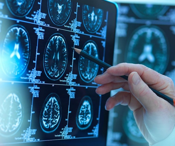 physician reviewing brain scans
