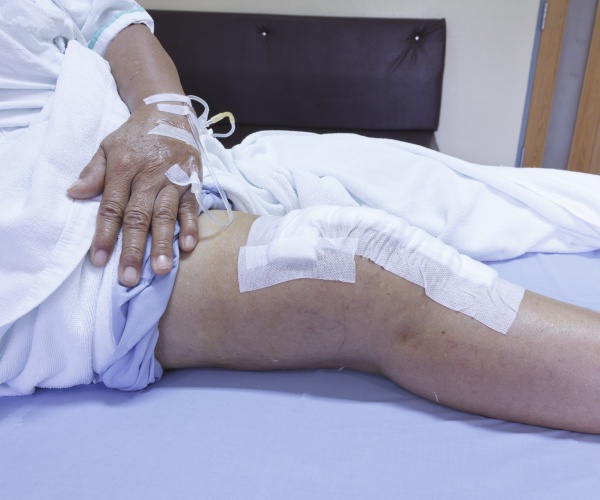 person's knee with bandages after knee replacement surgery