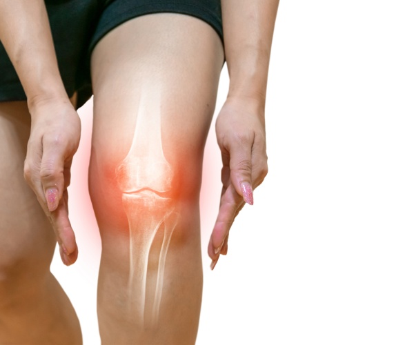 woman with hands around knee that illustrates pain, inflammation from arthritis