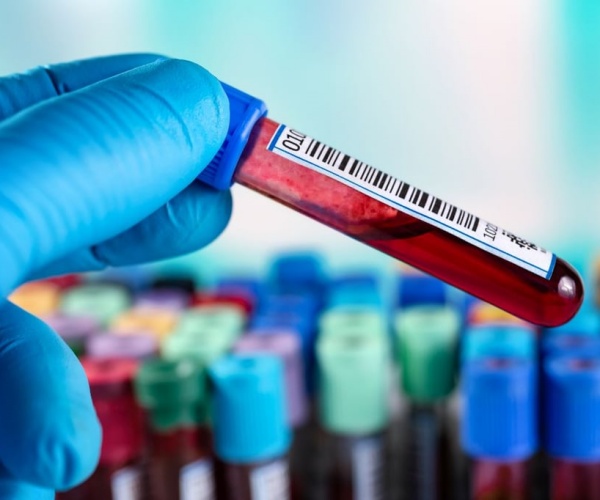 close-up of vial of blood