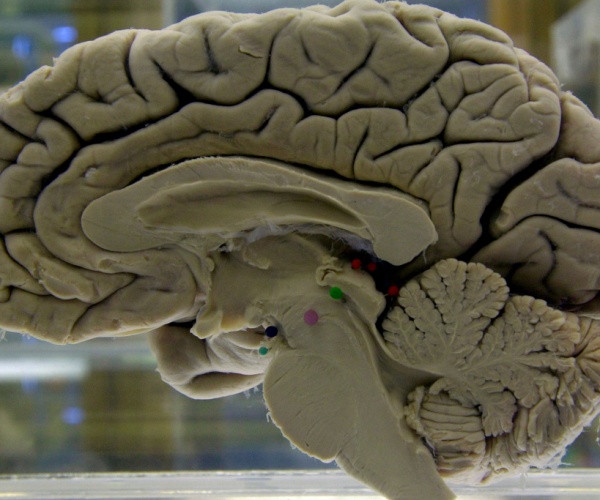 a model of the brain