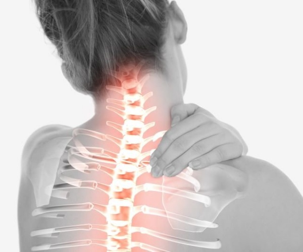 illustration of spine in woman's back, neck