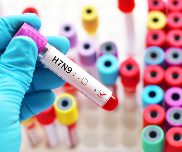 vial of blood positive for H7N9 bird flu