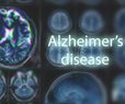 Alzheimer's Agitation Drug Trial Data Mixed

