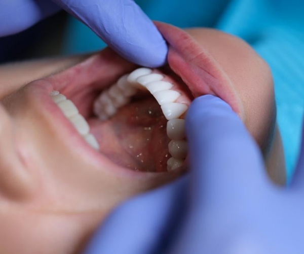 dentist examining patient's gums