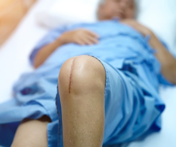 patient in hospital bed with total knee replacement scar