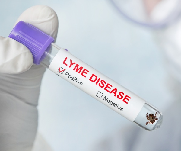 blood in vial positive for Lyme disease