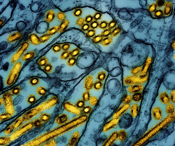 Type A H5N1 influenza under microscope