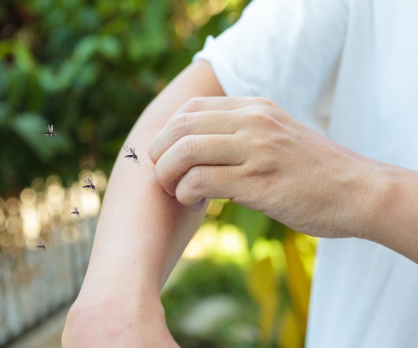 mosquito on person's arm outside