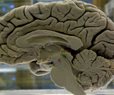How to Challenge Your Brain to Lower Dementia Risk