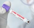 Study: Lyme Vaccine 70% Effective, Misses Key Goal