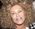 'Catwoman' Jocelyn Wildenstein, Known for Extreme Plastic Surgery, Dies